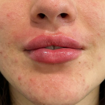 Slider image (9) Dentech Dental Centar